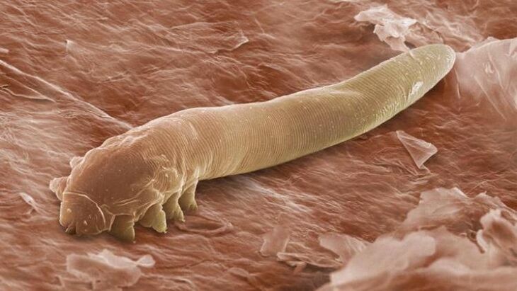 Wurm, der unter der menschlichen Haut lebt