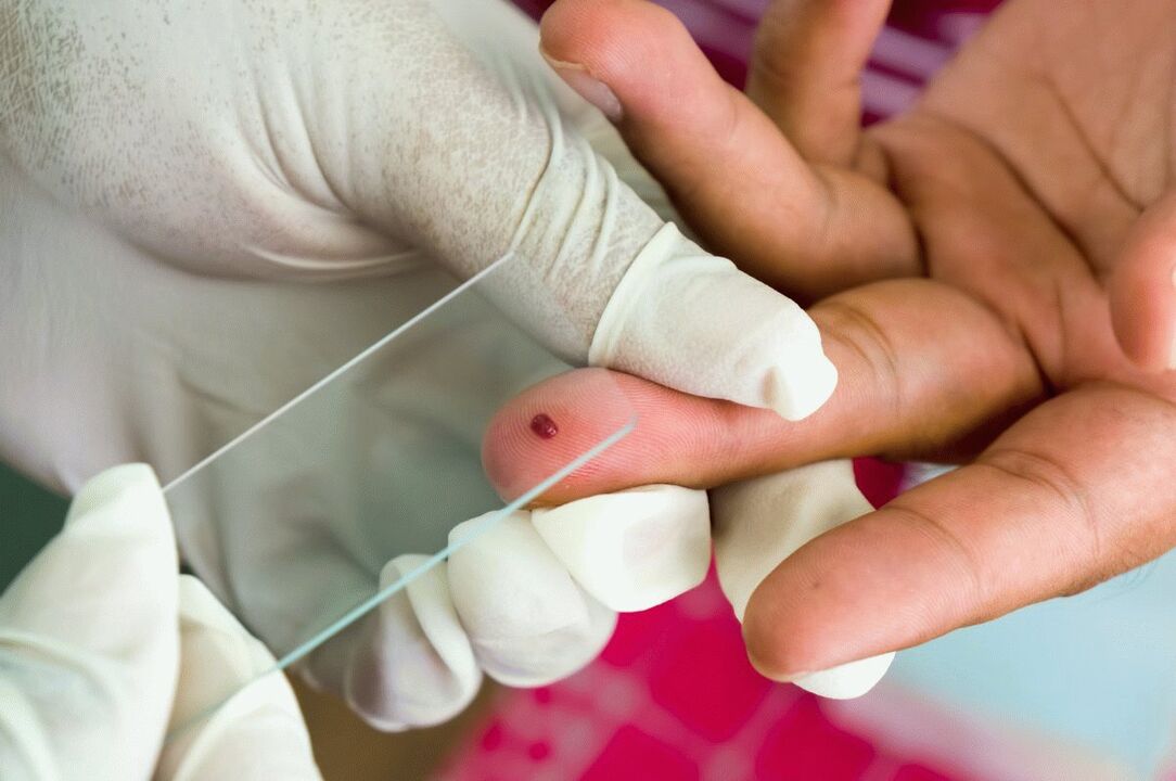 Bluttest aus dem Finger
