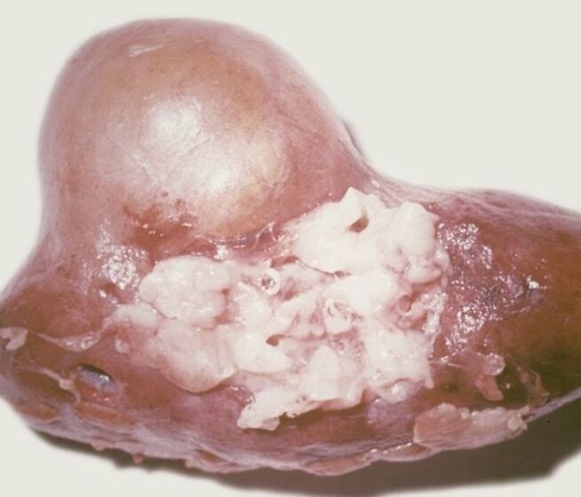 Was sind Parasiten
