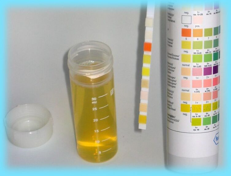 Urinanalyse